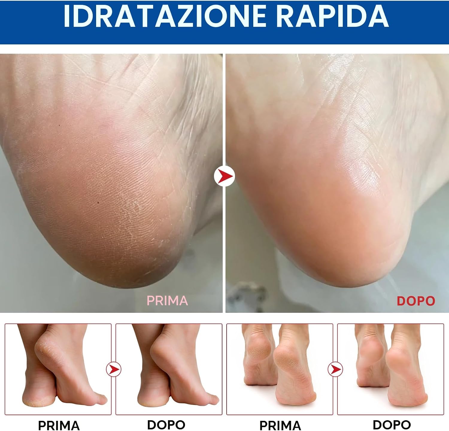 Crema Piedi Arricchita con Urea al 60% per Levigare la Pelle Ruvida e Dura, Idratazione Profonda per Piedi più Morbidi e Lisci,40g - immagine 3